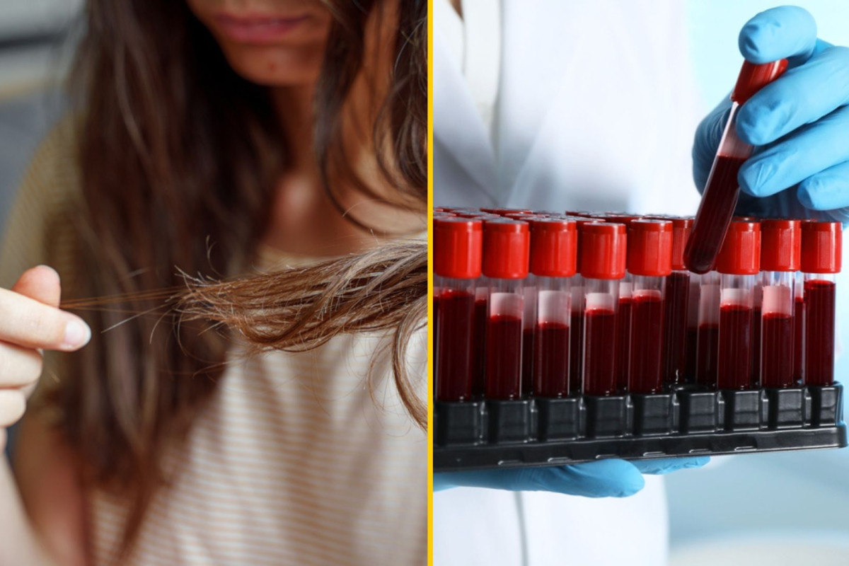 Szklanka tego soku dziennie i anemia odejdzie w niepamięć? Oto co odkryli naukowcy