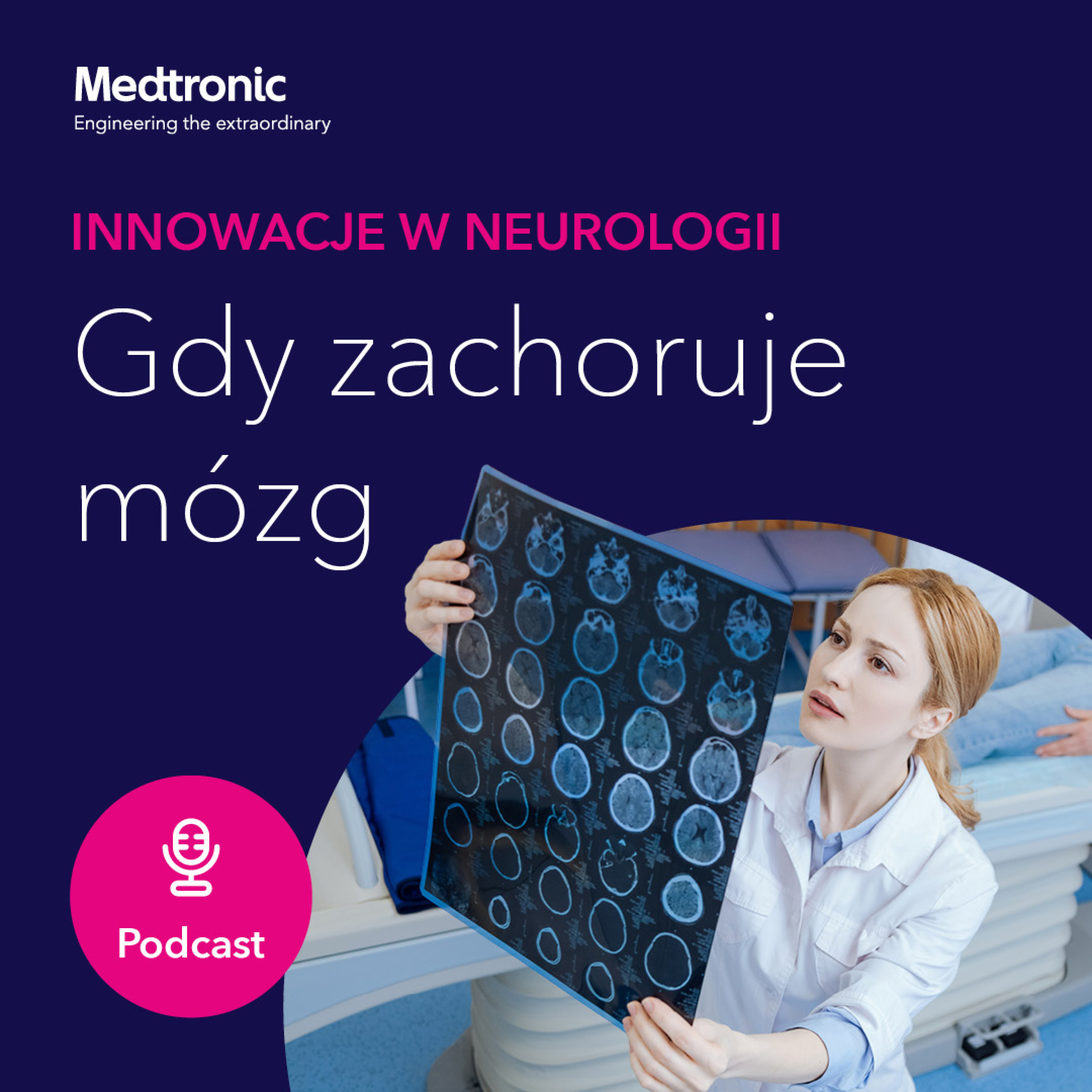 Gdy zachoruje mózg – innowacje w neurologii podcast artwork